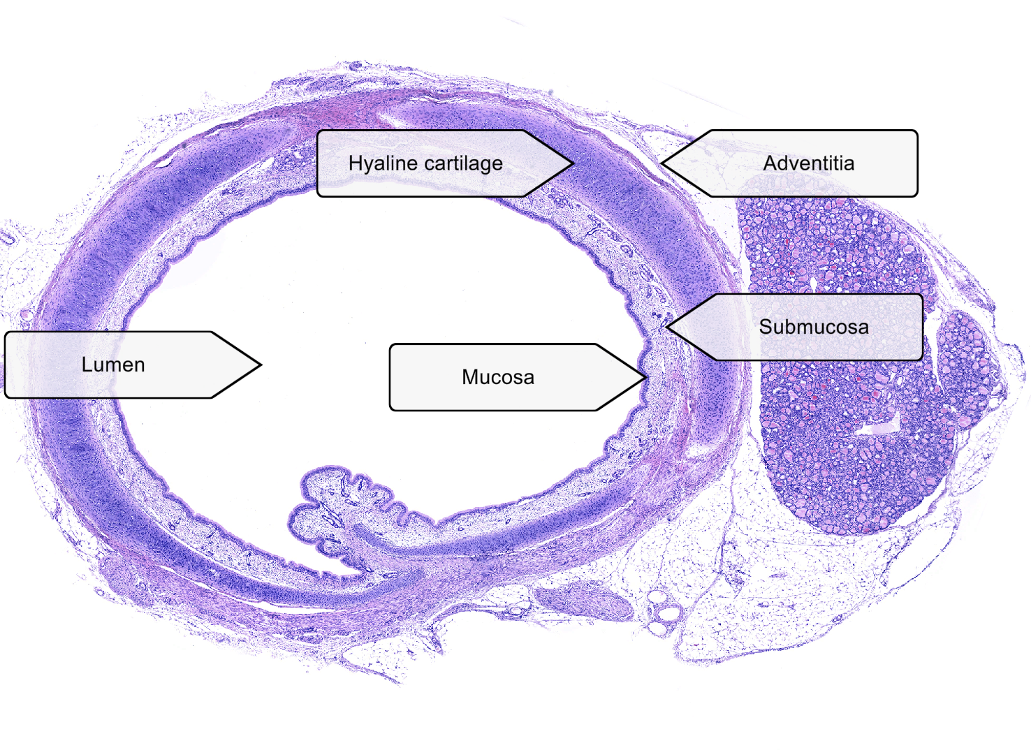 <p>Mucosa- <span>ciliated pseudostratified columnar epithelium</span>, Trachealis muscle</p>