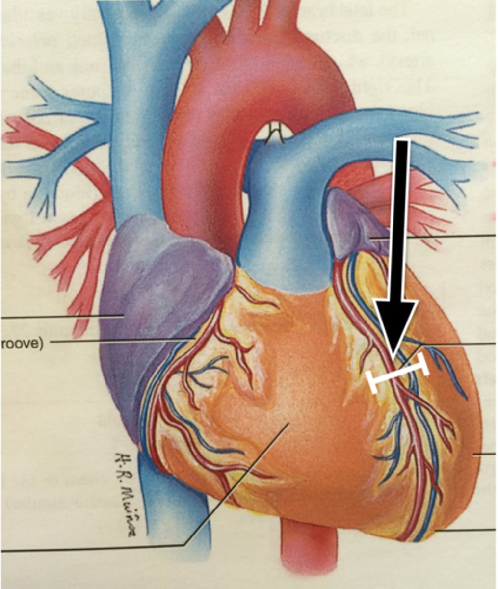 <p>depression. anterior of the heart.</p>