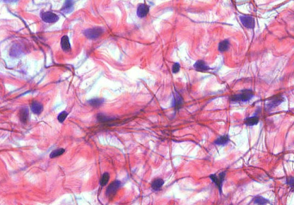 <p>• Fibroblasts</p><p>• Blood cells</p><p>• Adipocytes</p><p>• Collagen and elastic fibers</p>