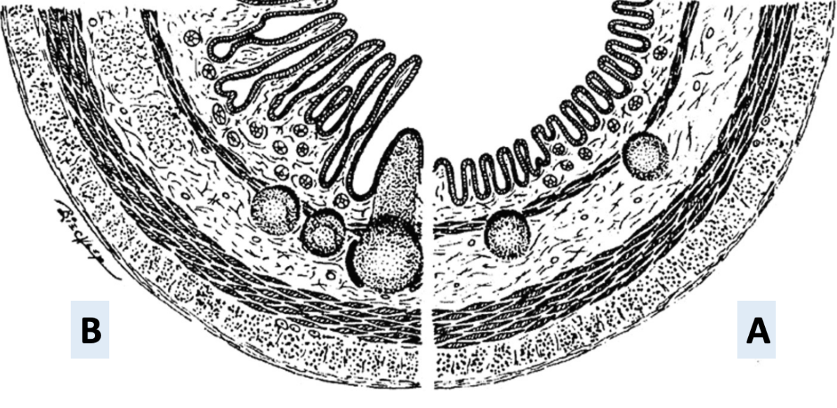 <p><strong><u>Small intestine:</u> </strong><span style="color: blue"><strong>B</strong></span></p><p><strong><u>Large intestine:</u> </strong><span style="color: green"><strong>A</strong></span></p><p><strong><u>Because:</u> </strong><span style="color: purple"><strong>Tunica mucosa </strong></span>is more <span style="color: purple"><strong>uniform</strong></span><strong> </strong>and <span style="color: purple"><strong>flat</strong></span><strong> </strong></p><p></p>