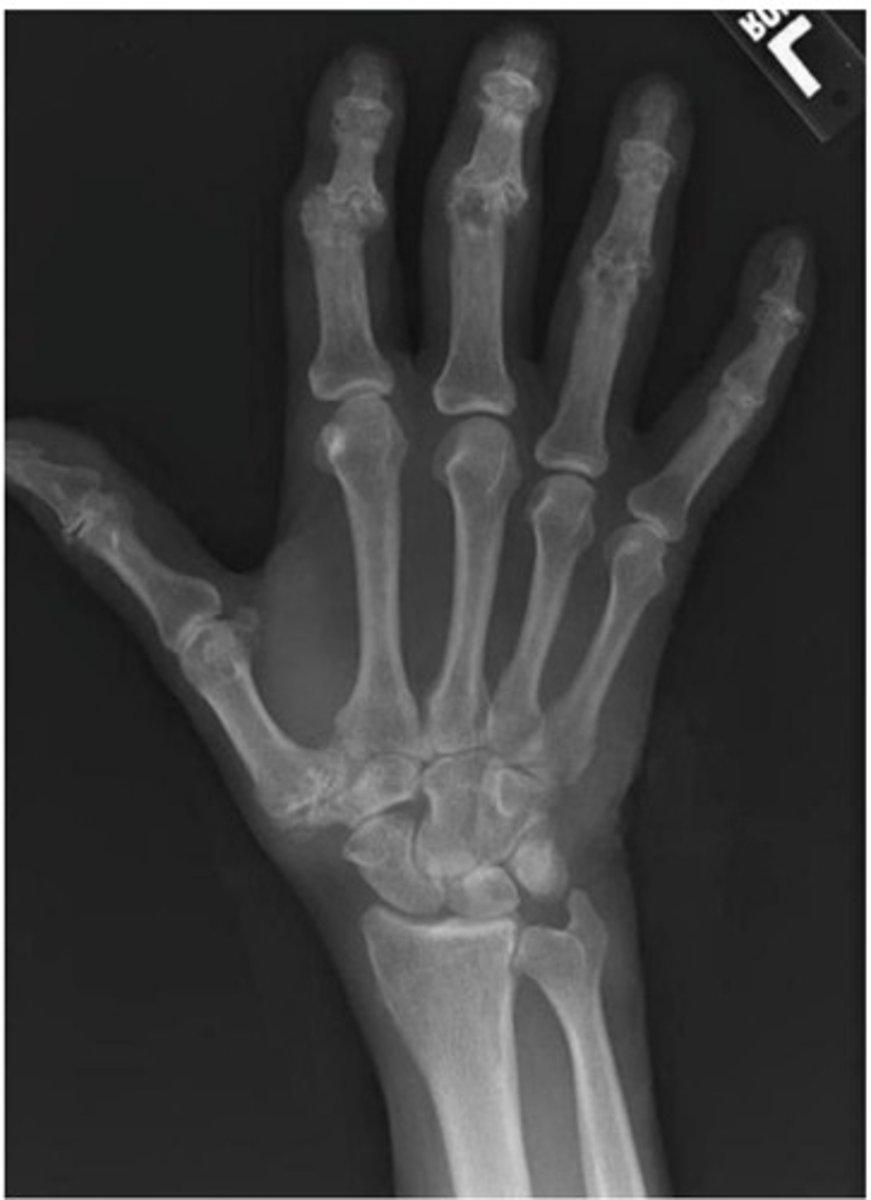 <p>What diagnosis is this?</p>