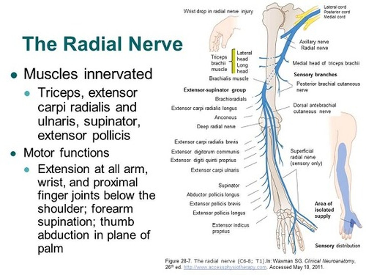 <p>Spinal Roots: C5-T1</p><p>Cause of Injury:</p><p>- midshaft fracture of the humerus</p><p>- compression of the axilla (ie: crutches, sleeping with arm over chair "saturday night palsy")</p><p>Presentation:</p><p>- WRIST DROP: loss of elbow, wrist and finger extension (because radial does ALL the extensors)</p><p>- decreased grip strength (wrist extension necessary for maximal action of flexors)</p><p>- loss of sensation over posterior arm/forearm and dorsal hand</p>