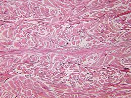 <p>Name this connective tissue. </p>