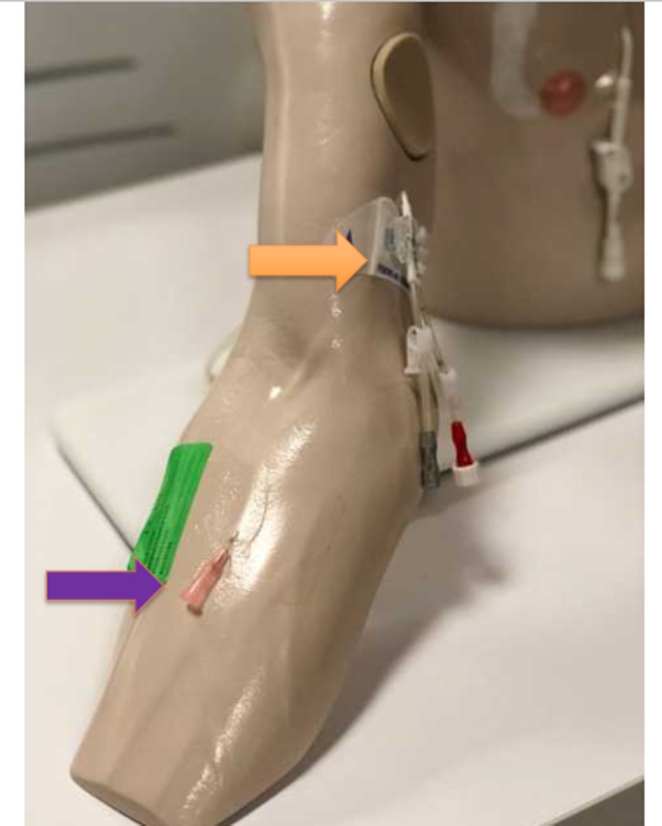 <p>What does purple arrow show?</p>