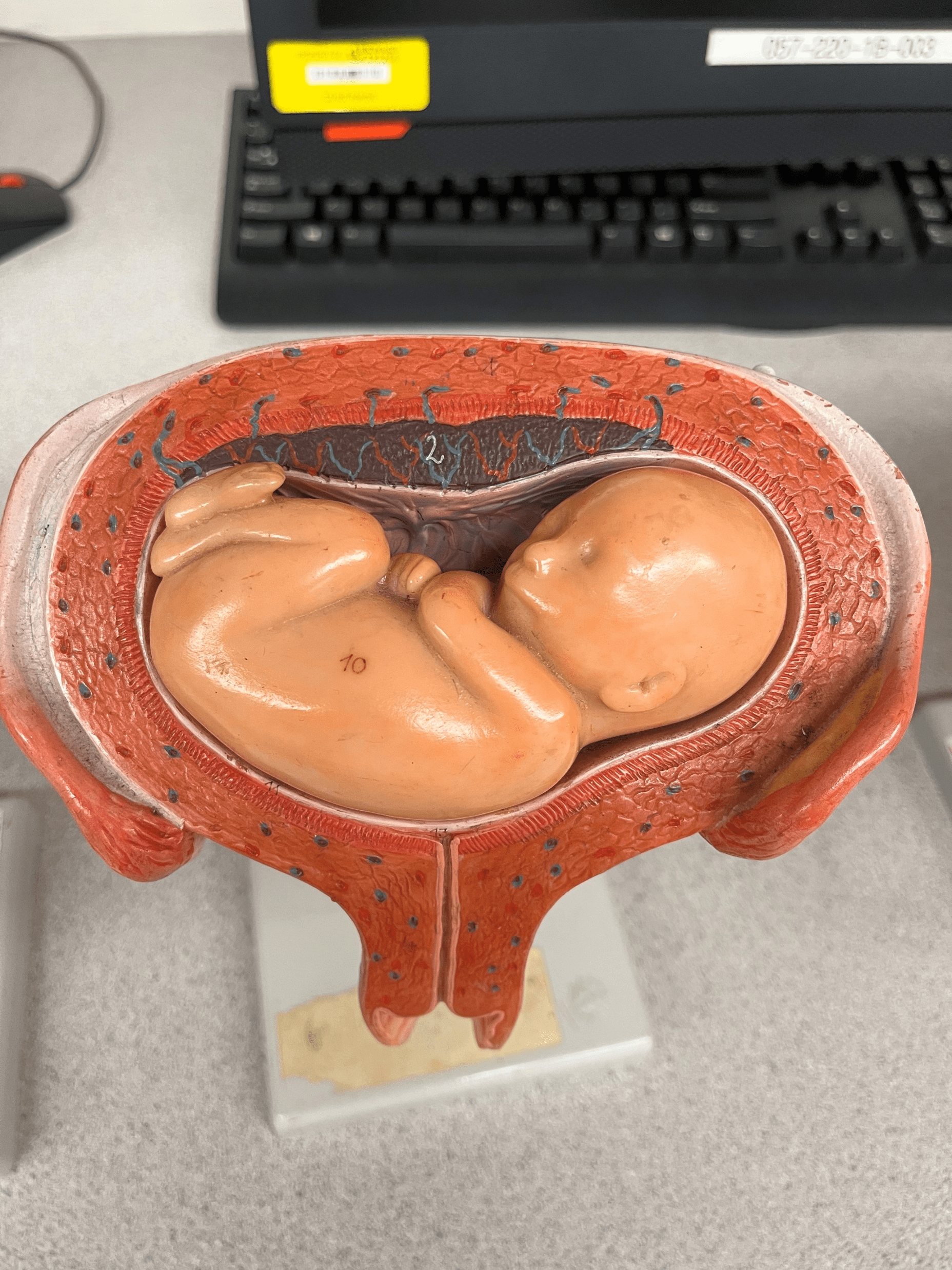 • Model of the developing fetus in the uterus.

• The position in which the fetus faces upwards.

• Also known as the supine position.