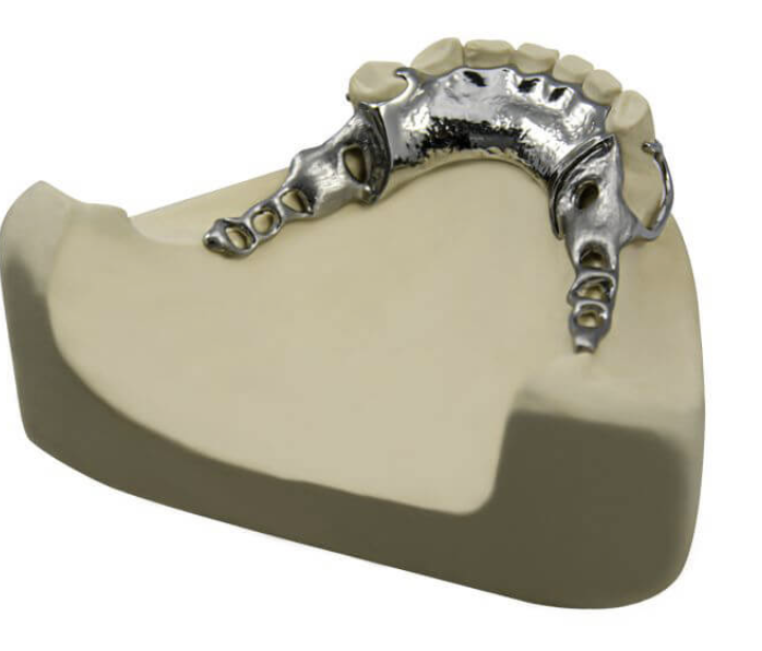 <ul><li><p>Description : barre continue avec appui sur les cingulums des dents </p></li><li><p>Indications : classe I et II </p></li></ul><p></p>