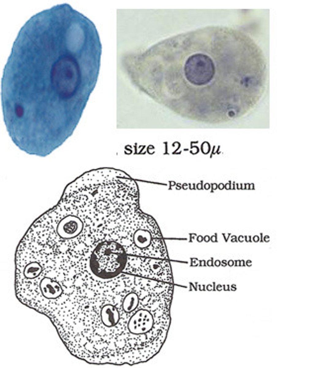 <p>*note the dot...absent in histolytica<br>*may ingest bacteria<br>*granular cytoplasm, sluggish motility</p>