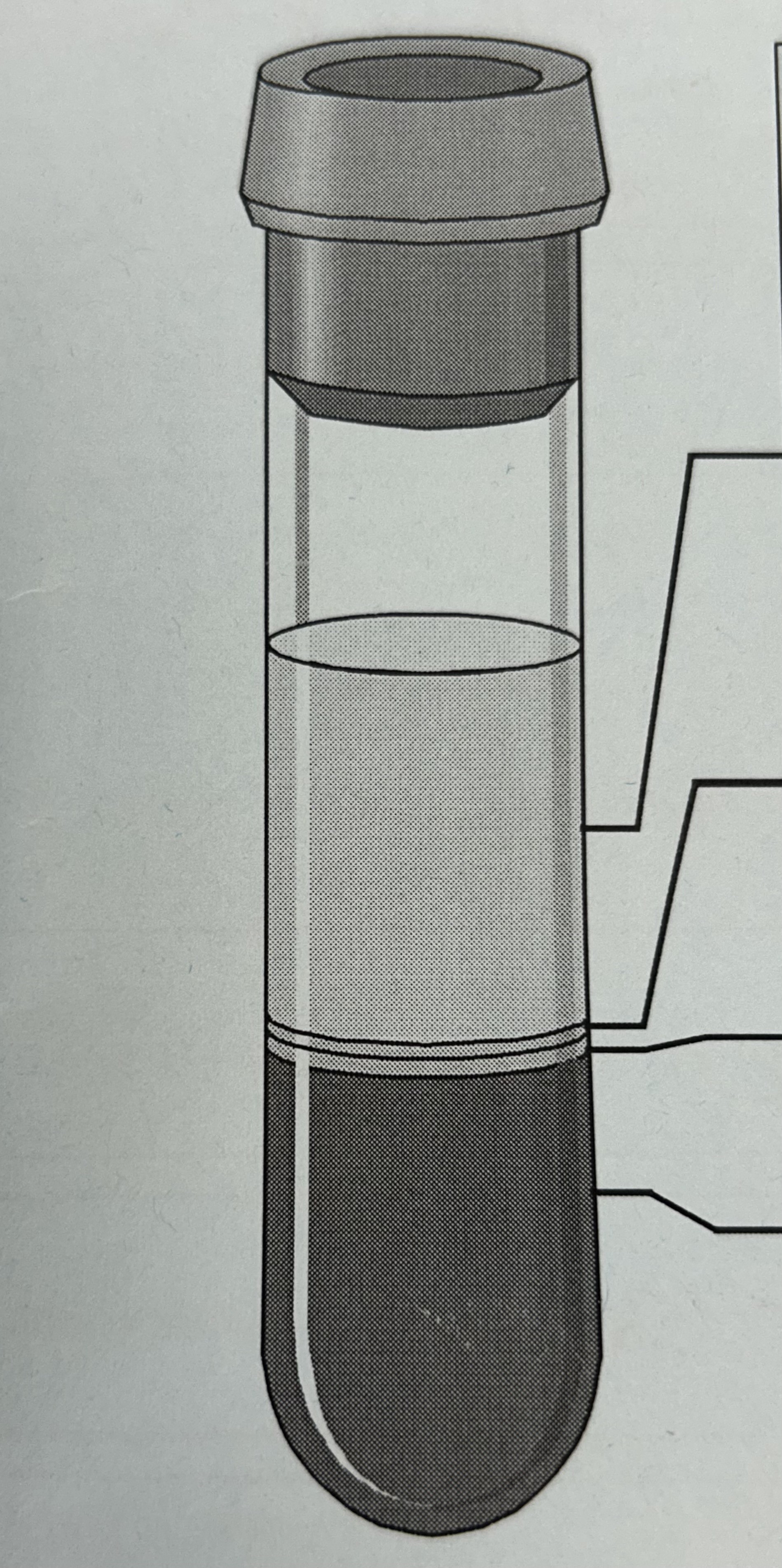 <p>what is the top liquid part of this blood sample?</p>