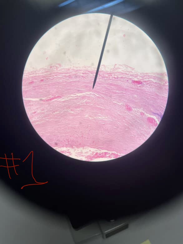 <p>Name the muscle</p>