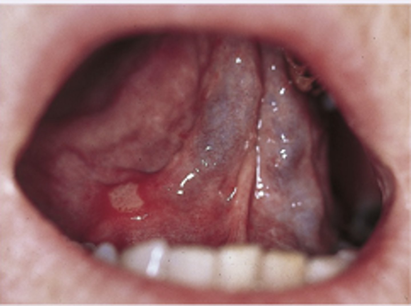 <p>Diagnosis?</p>