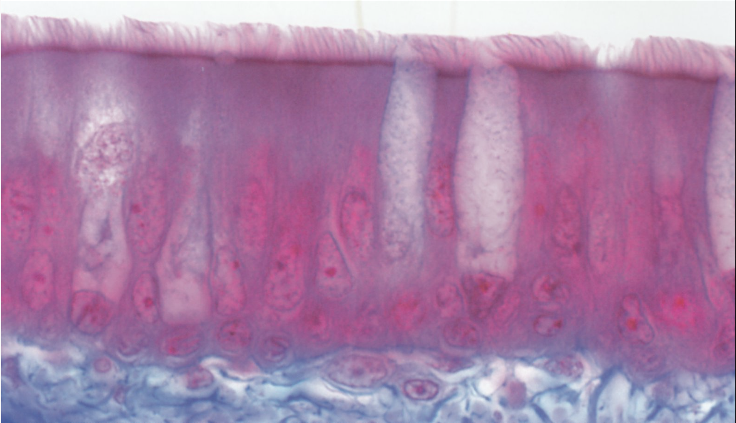 <p>C. Respiratory epithelium</p>