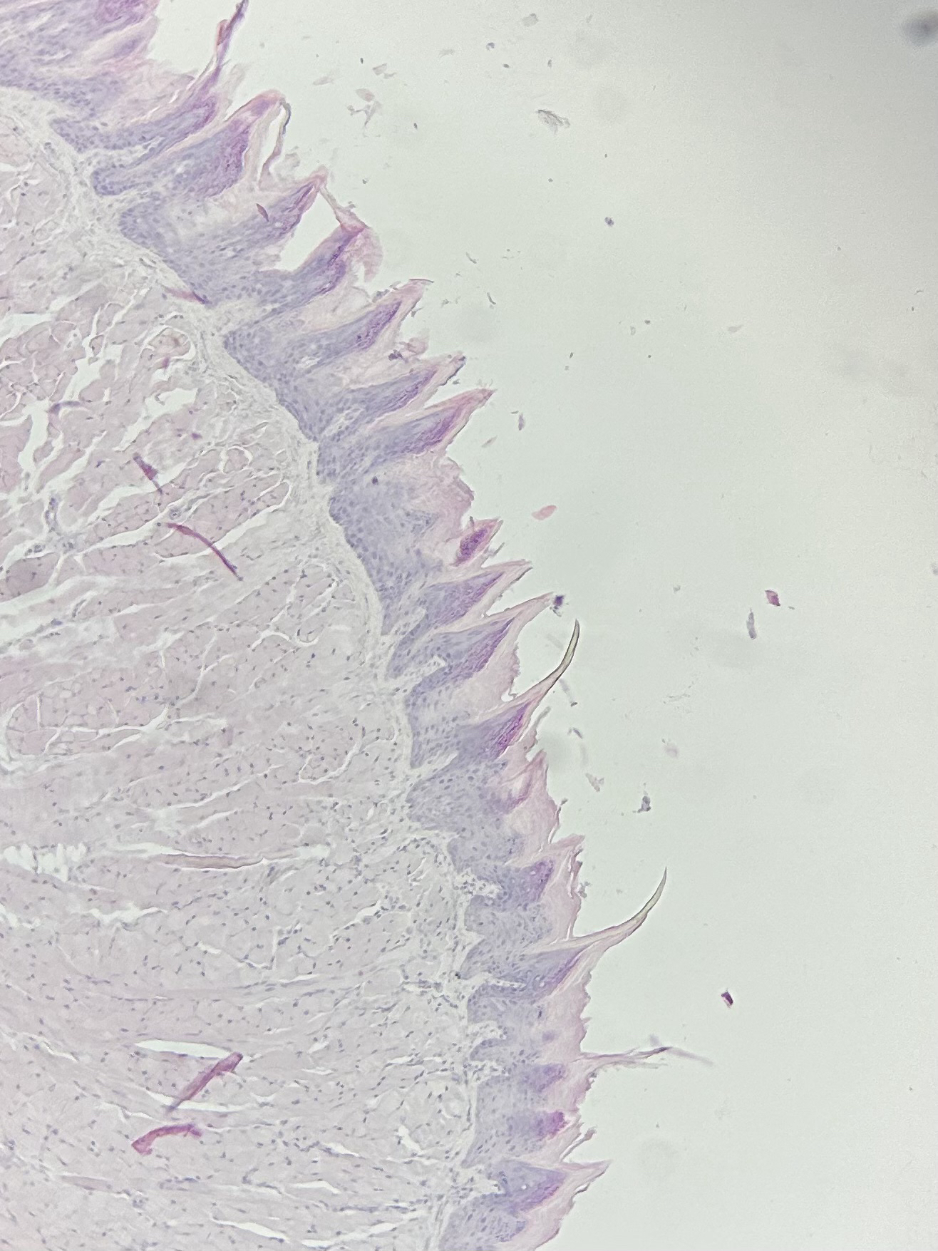 term image