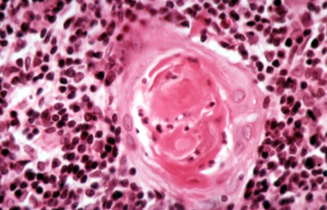 <p><strong>Thymus</strong></p><p><em>Hassall’s corpuscles</em></p>