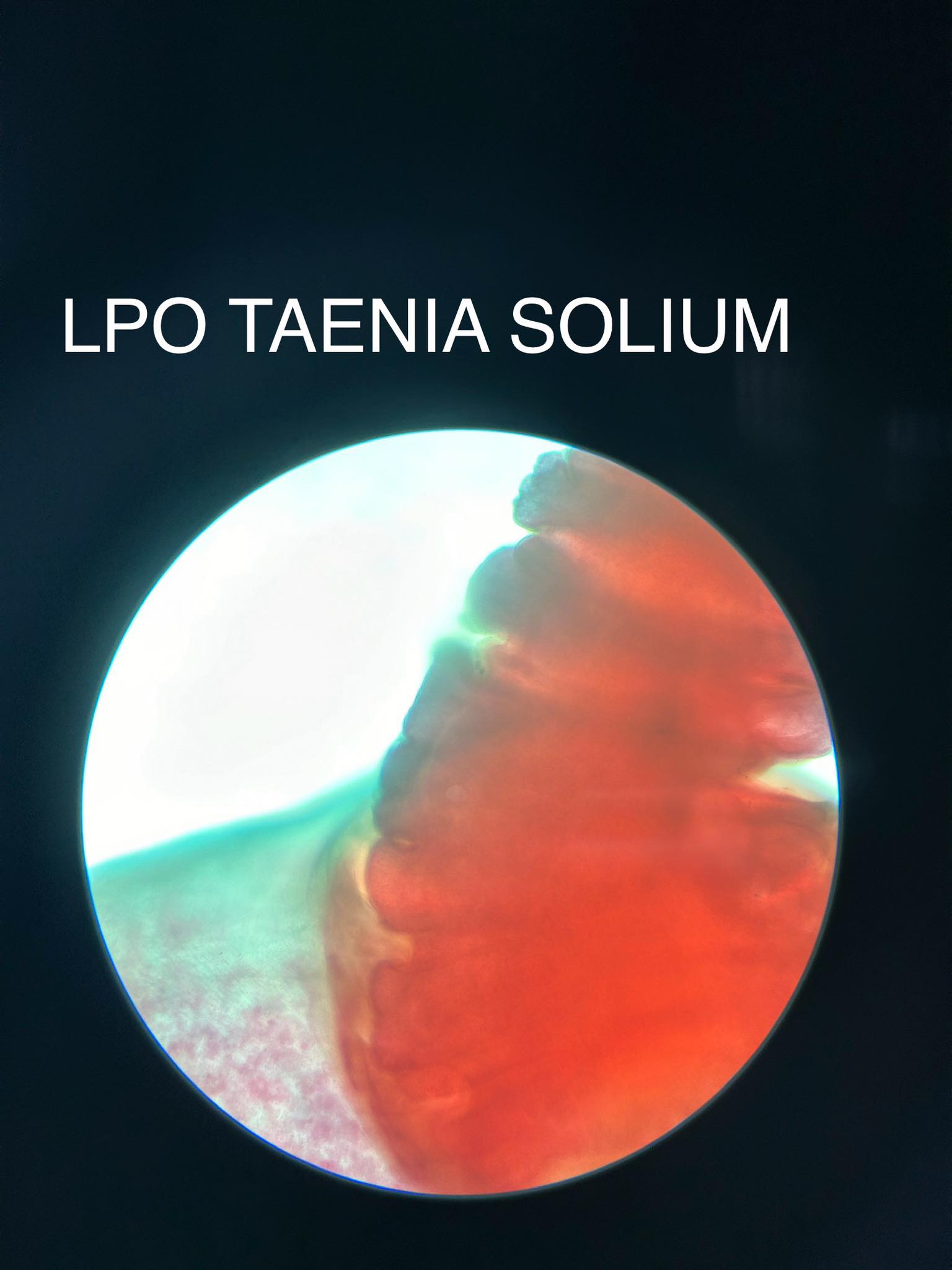 <p>Taenia solium</p>