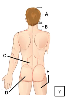 <p>Gluteal</p>