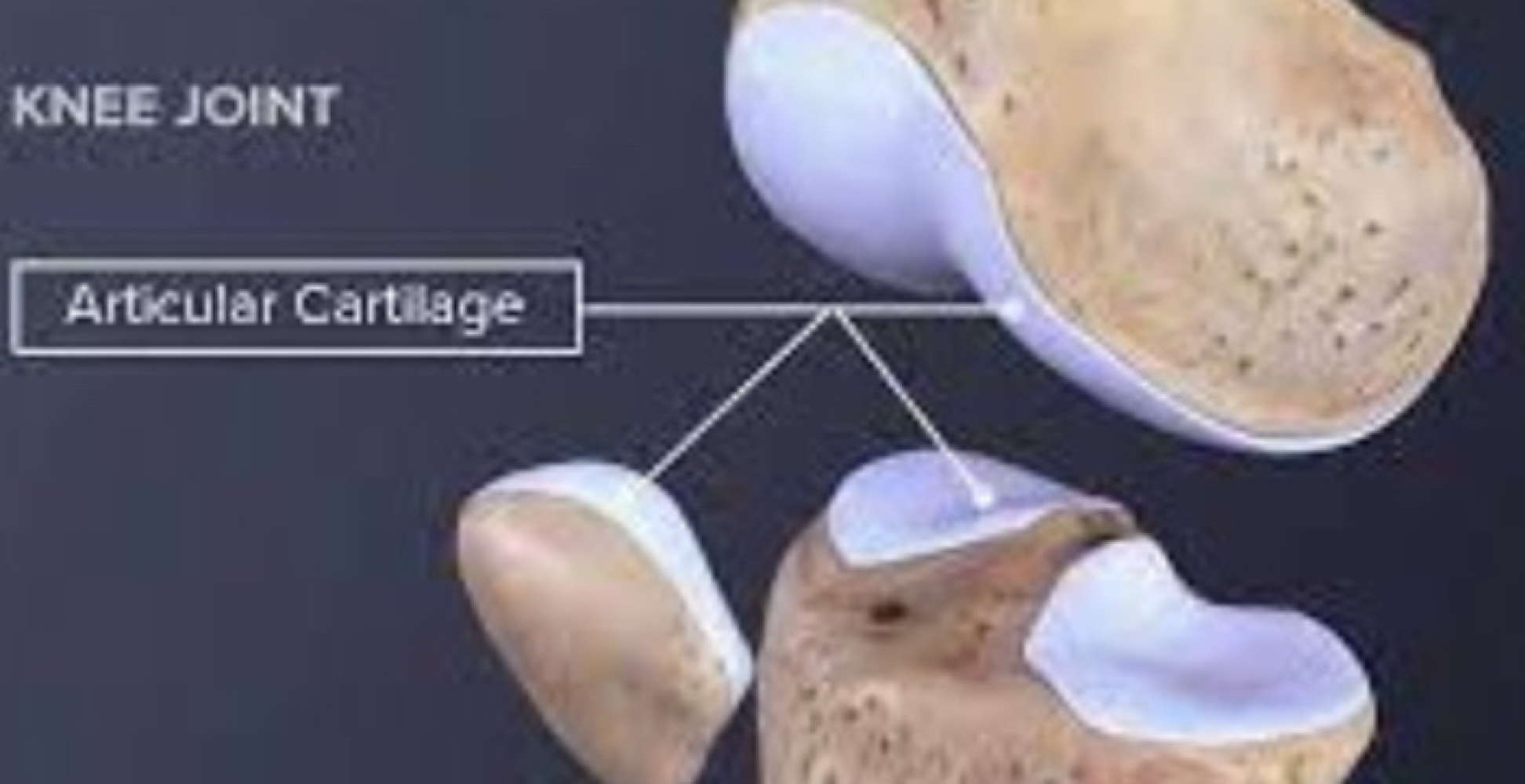 <p><span style="color: rgb(131, 205, 71)"><strong>Cartilage </strong></span></p>