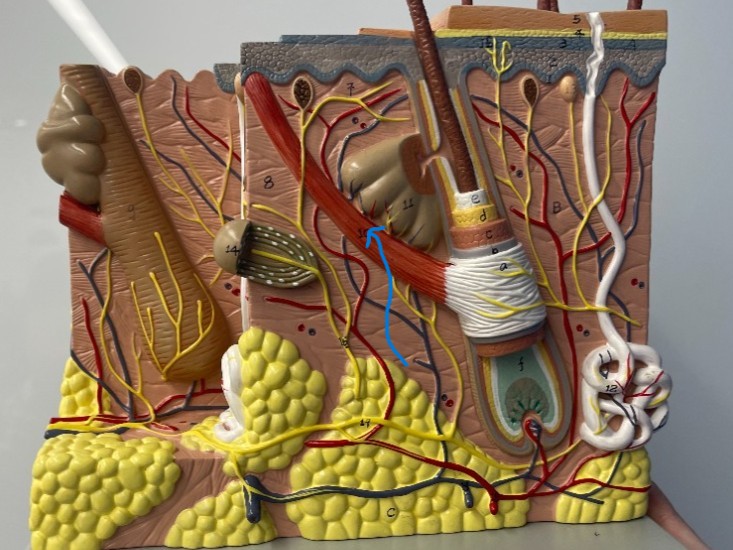 term image