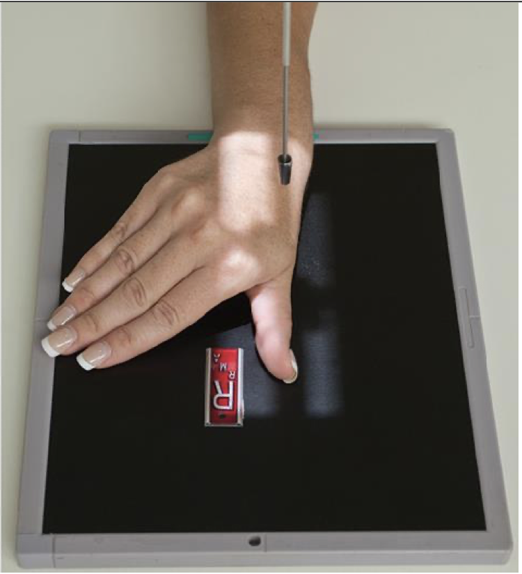 <p>Patient Position</p><ul><li><p><span style="line-height: normal;"> </span>Same as PA &amp; Oblique</p></li></ul><p>Part Position</p><ul><li><p><span style="line-height: normal;"> </span>Place hand flat on IR ( same as oblique) and flex the fingers to “roll” thumb to a lateral position</p></li><li><p class="p1"><span style="line-height: normal;"> </span>Hand may be positioned in a loose fist as well</p></li><li><p class="p1"><span style="line-height: normal;"> </span>Rotate hand medially to place thumb in a true lateral</p></li><li><p class="p1"><span style="line-height: normal;"> </span>Thumbnail is the profile</p></li><li><p class="p1"><span style="line-height: normal;"> </span>Abduct thumb slightly</p></li></ul><p class="p1">CR</p><ul><li><p class="p1">Center to 1<span style="line-height: normal;">st </span>MCP</p></li></ul><p class="p1">Collimation</p><ul><li><p class="p1">Collimate to include entire thumb and trapezium</p></li></ul><p></p>