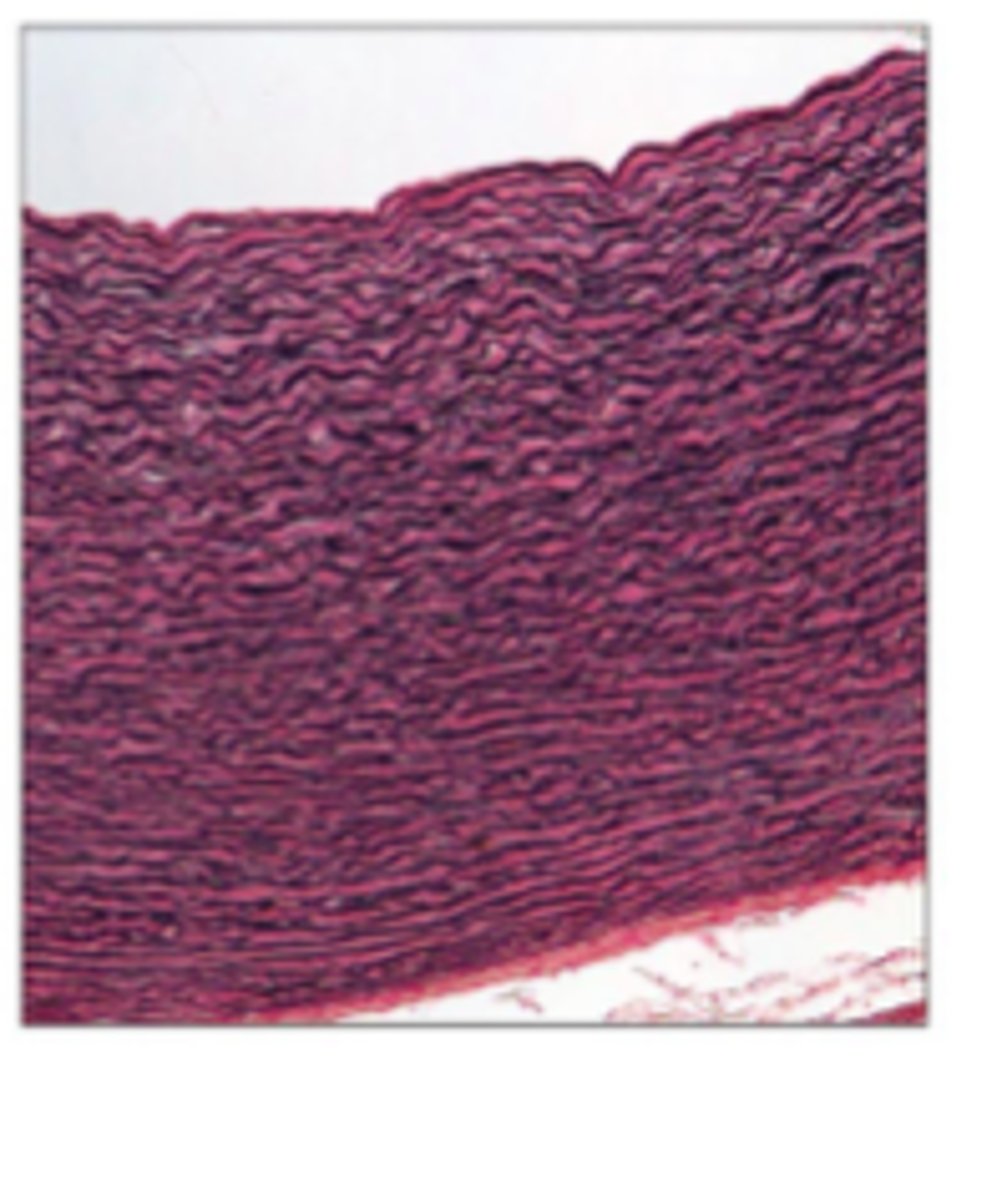 <p>Dense regular with elastic fibers; Function: Allows stretch and recoil; Location: Walls of large arteries, bronchial tubes.</p>