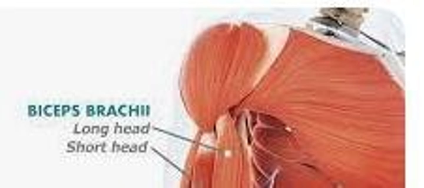 <p>Biceps brachii.</p>