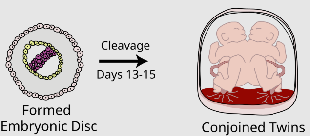 <p>two offspring are physically attached due to poor division of zygote</p>