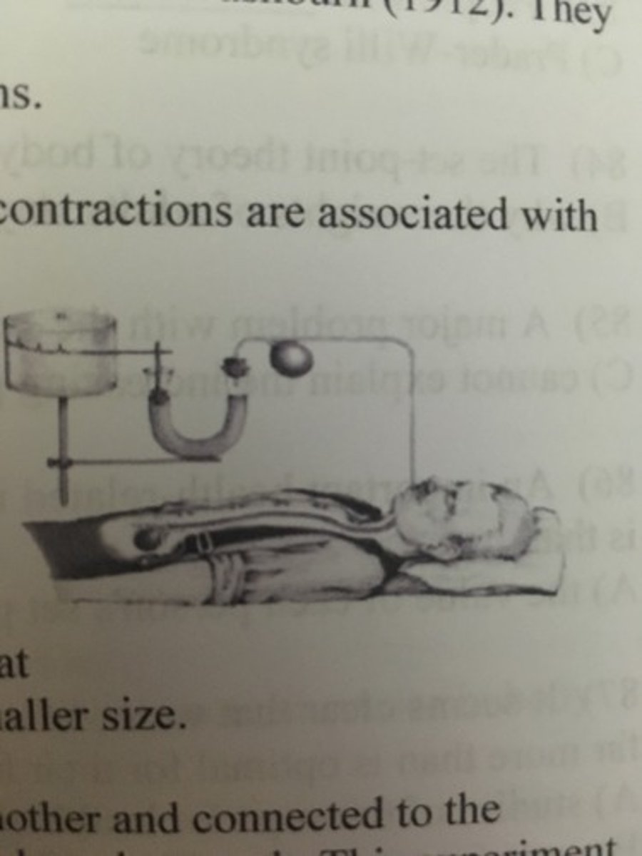<p>B) hunger</p>