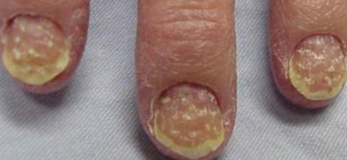 <p>What is the diagnosis?</p>