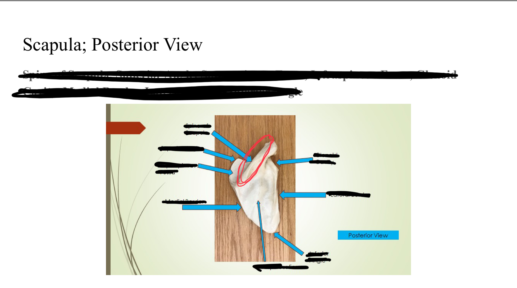 <p>Spine of scapula </p>