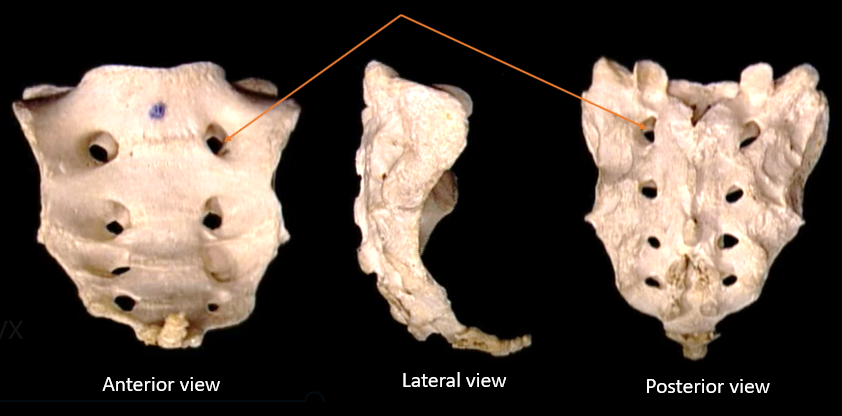 sacral foramen 