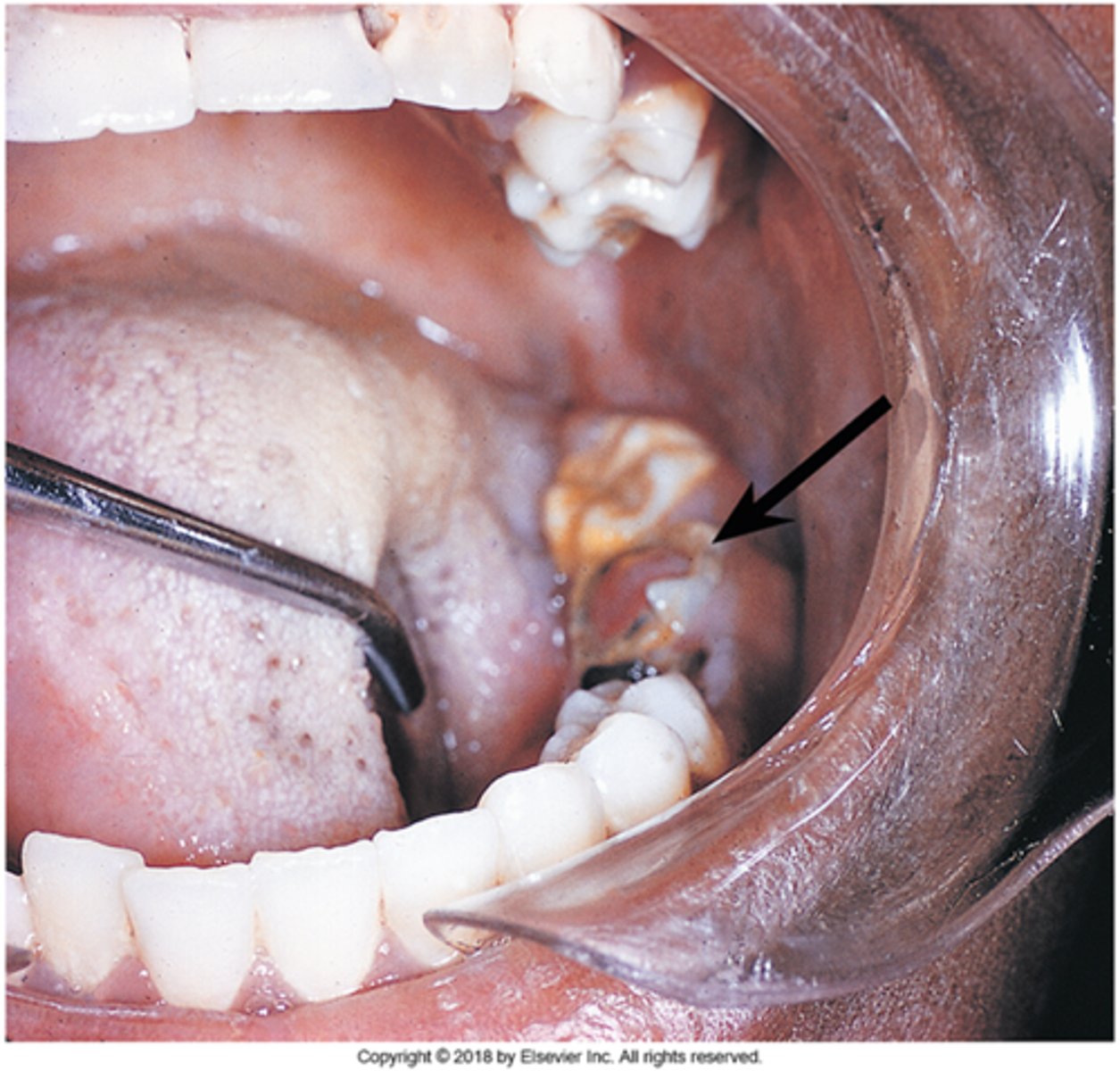 knowt flashcard image