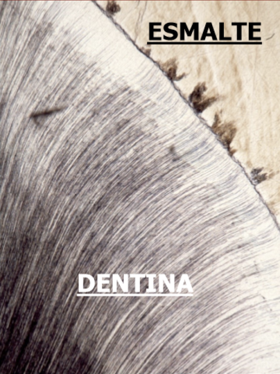 <p>Estructura del diente</p>