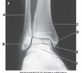<p>How should the lower limb be positioned to achieve the projection shown in the image below</p>