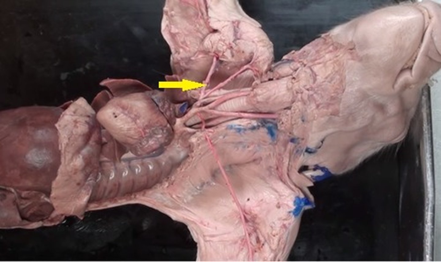 <p>Subclavian arteries</p>