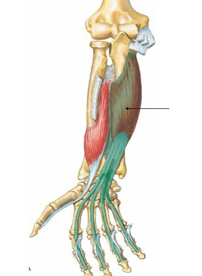 <p>What muscle is indicated?</p>