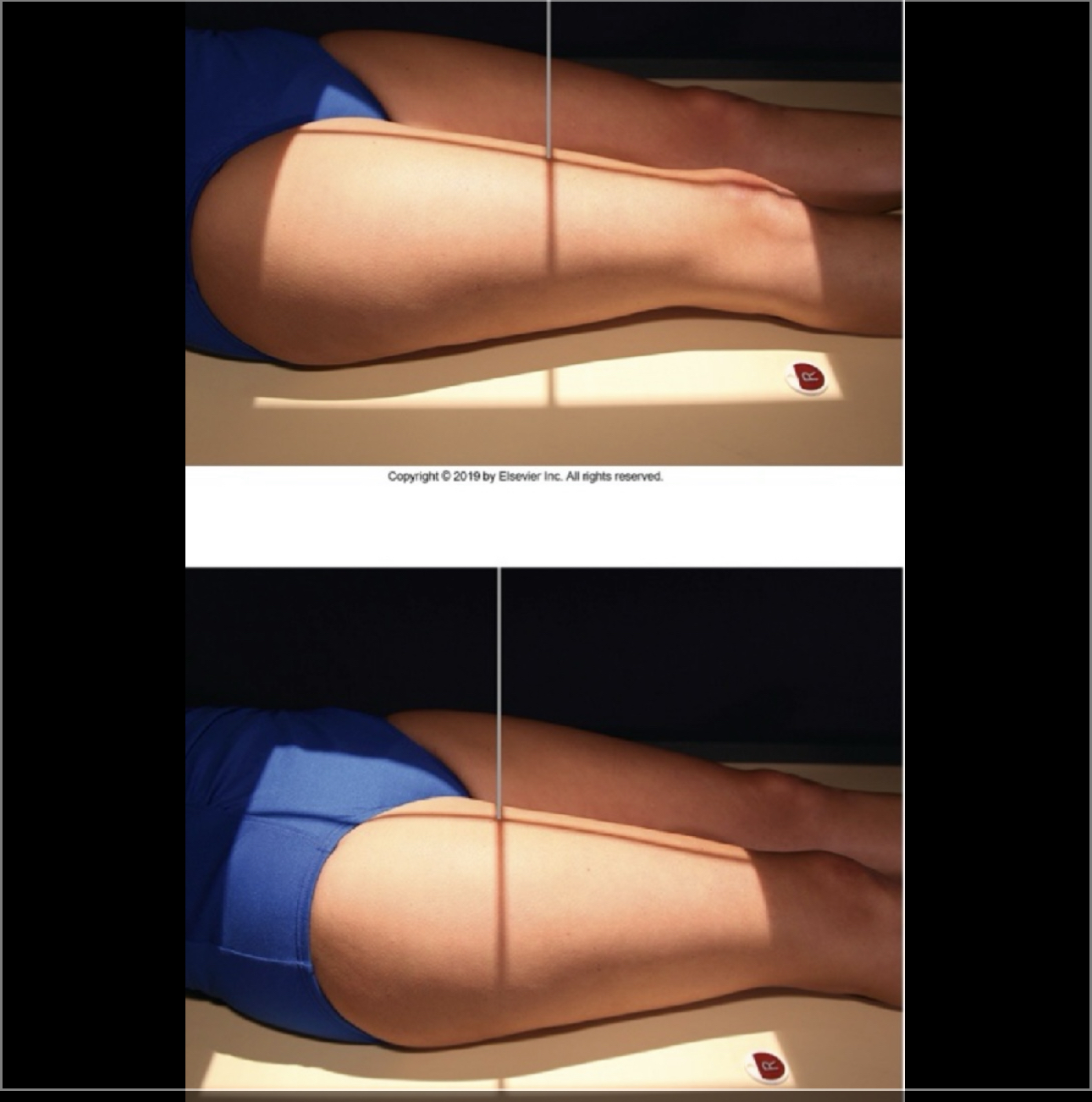 <p>What Projection is this?</p>