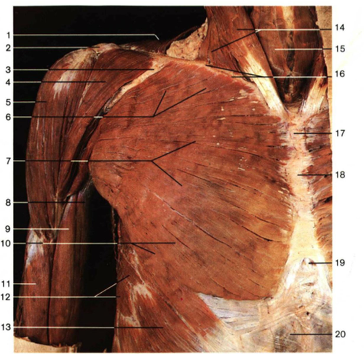 <p>Chest</p>