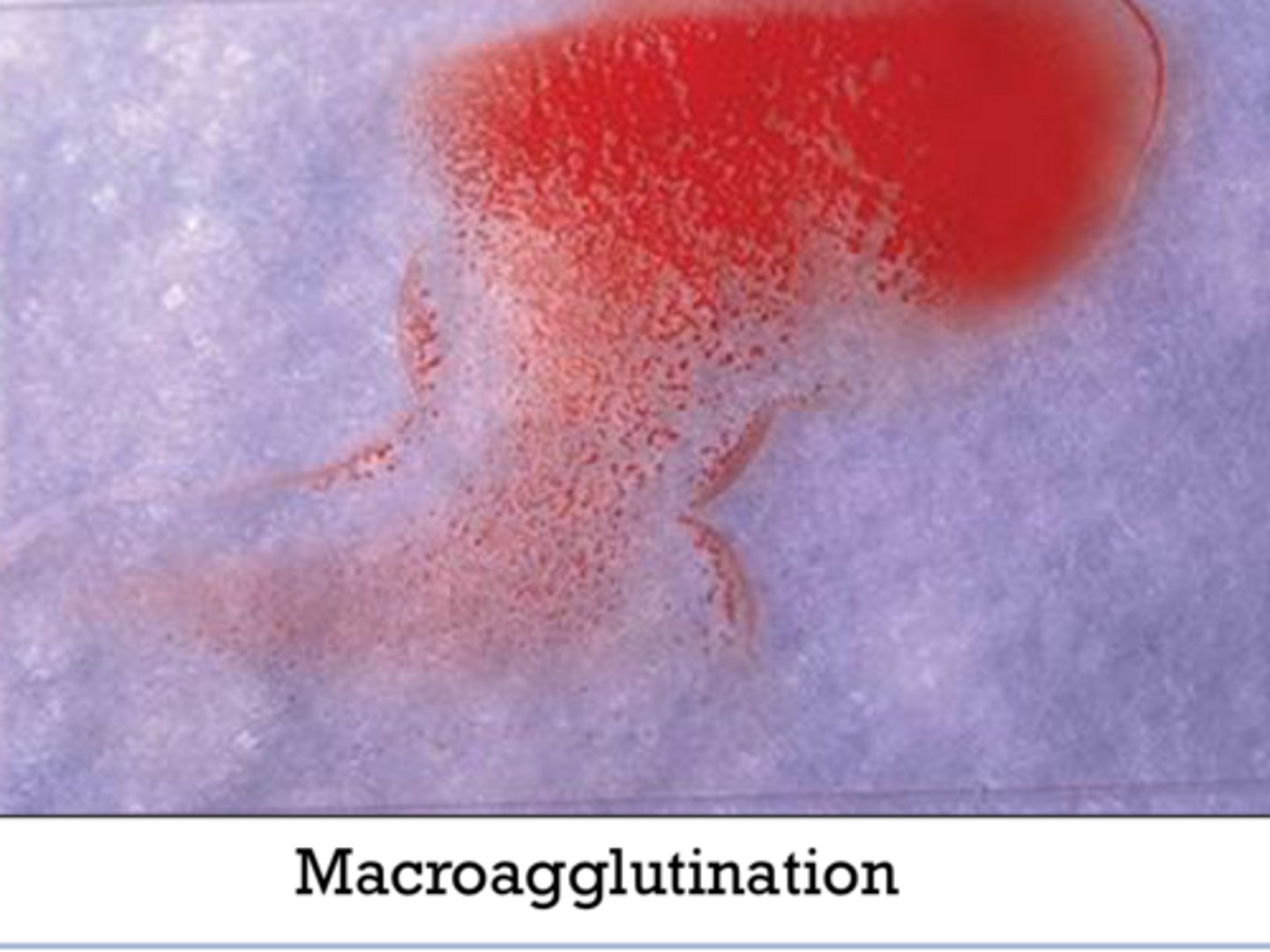 <p>How do you tell the difference between Rouleaux and agglutination?</p>