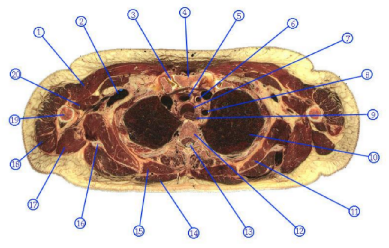 <p>What is structure 9?</p>