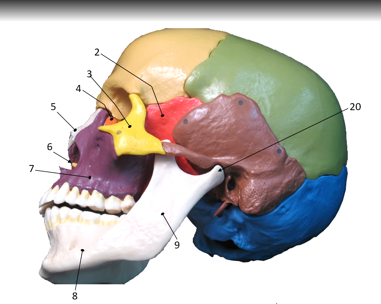 <p>Greater Wing of the Sphenoid Bone</p>