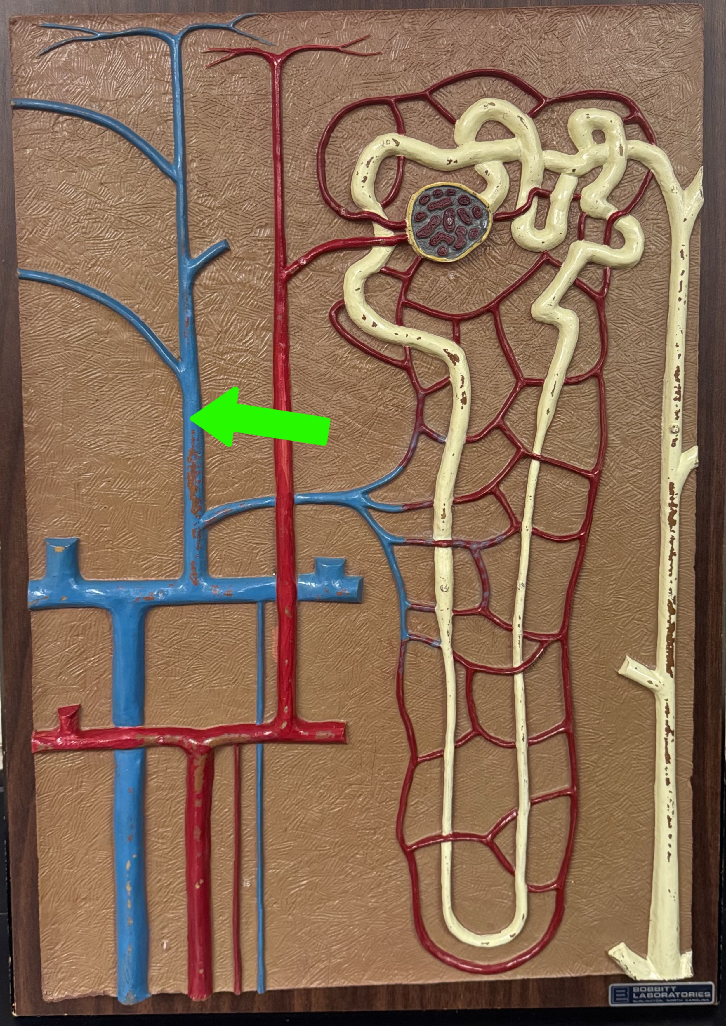 <p>What are these parts of the nephron?</p>