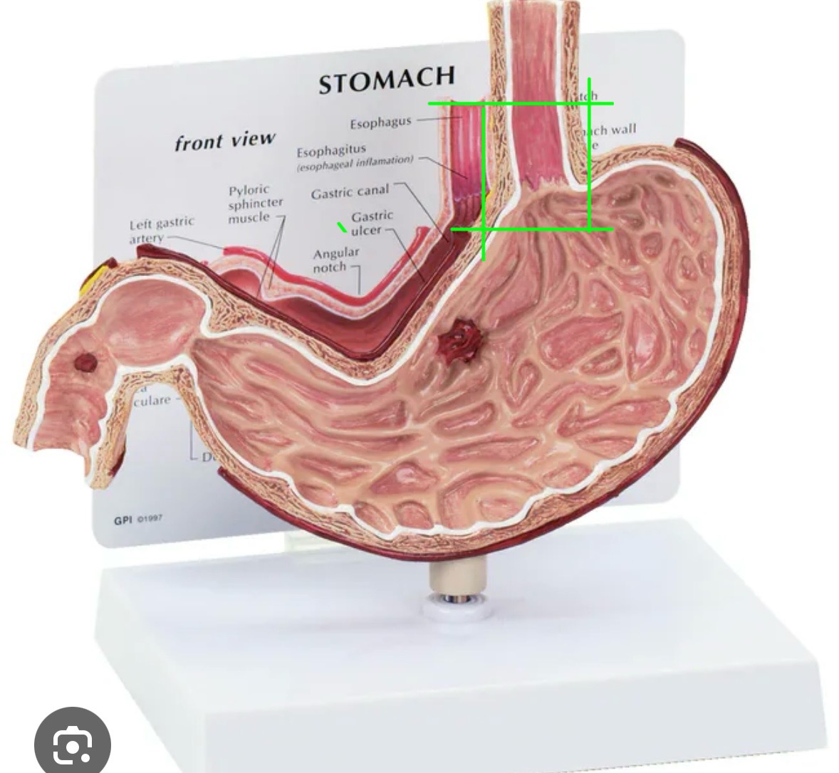 <p>What sphincter is this? </p>