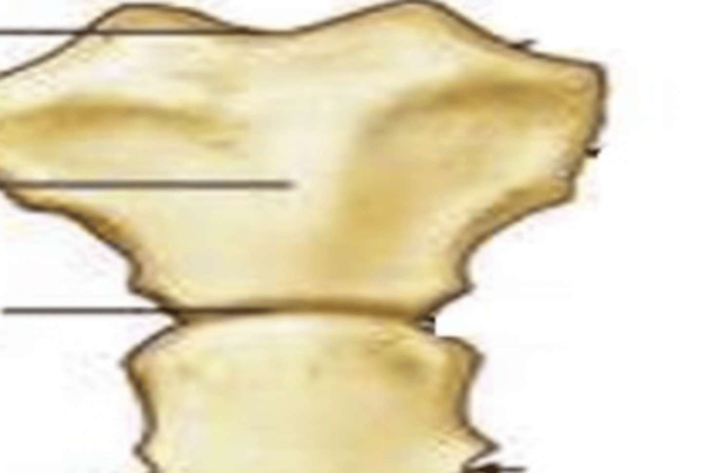 <p>(top)</p><p>Jugular</p><p>Notch</p><p>Manubrium</p><p>(bottom)</p>