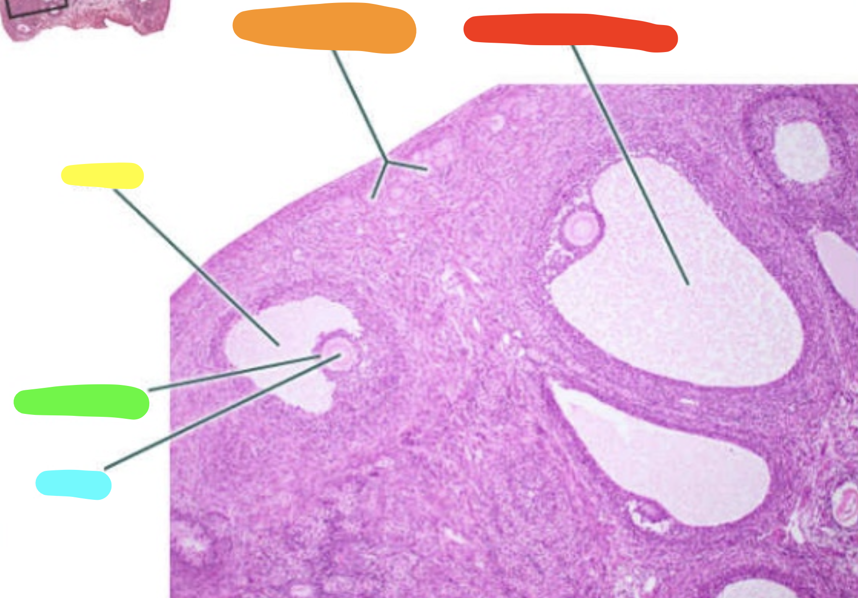 <p>What is this a slide of?</p>