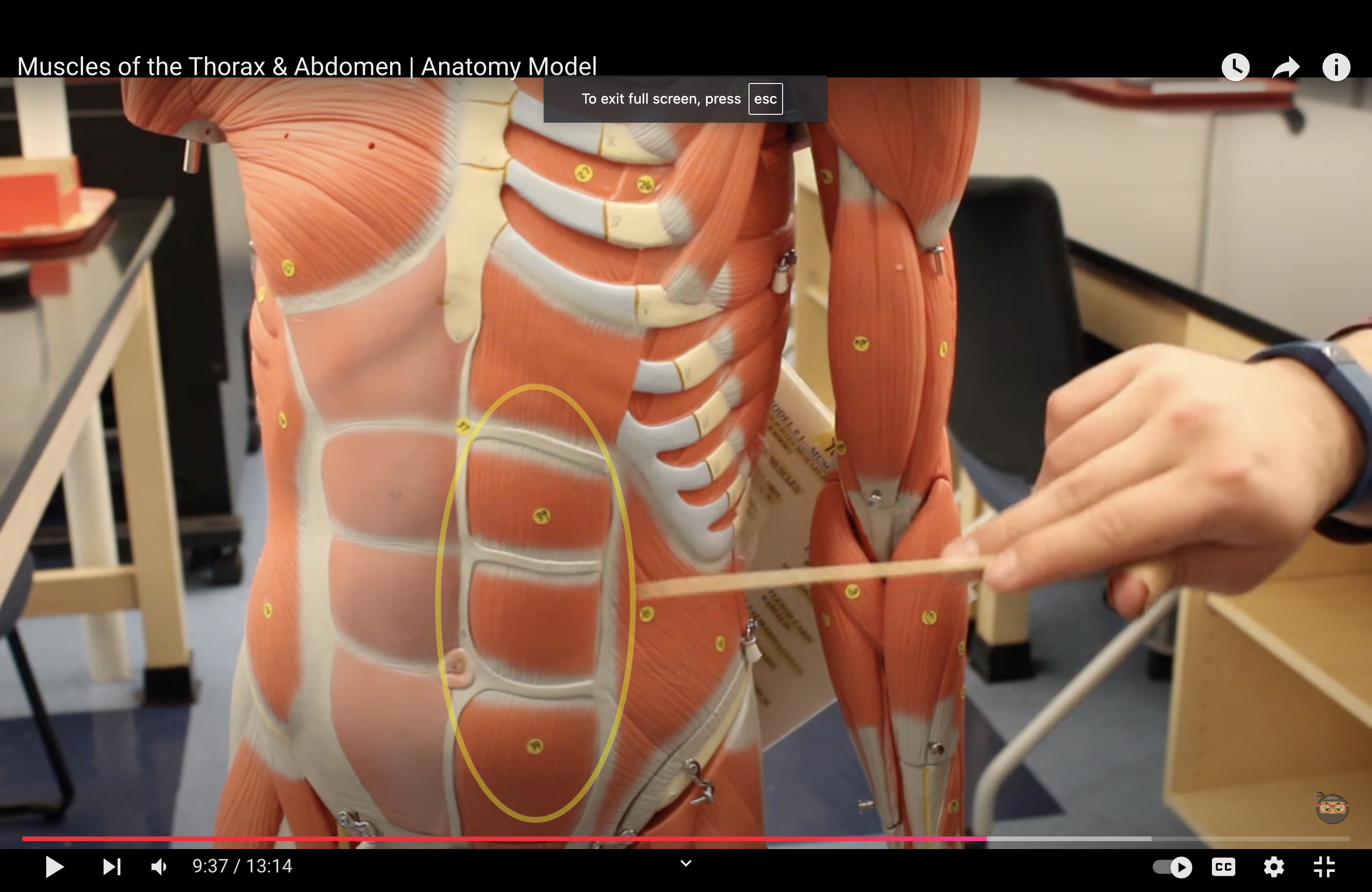 <p>What muscle is this?*****</p>