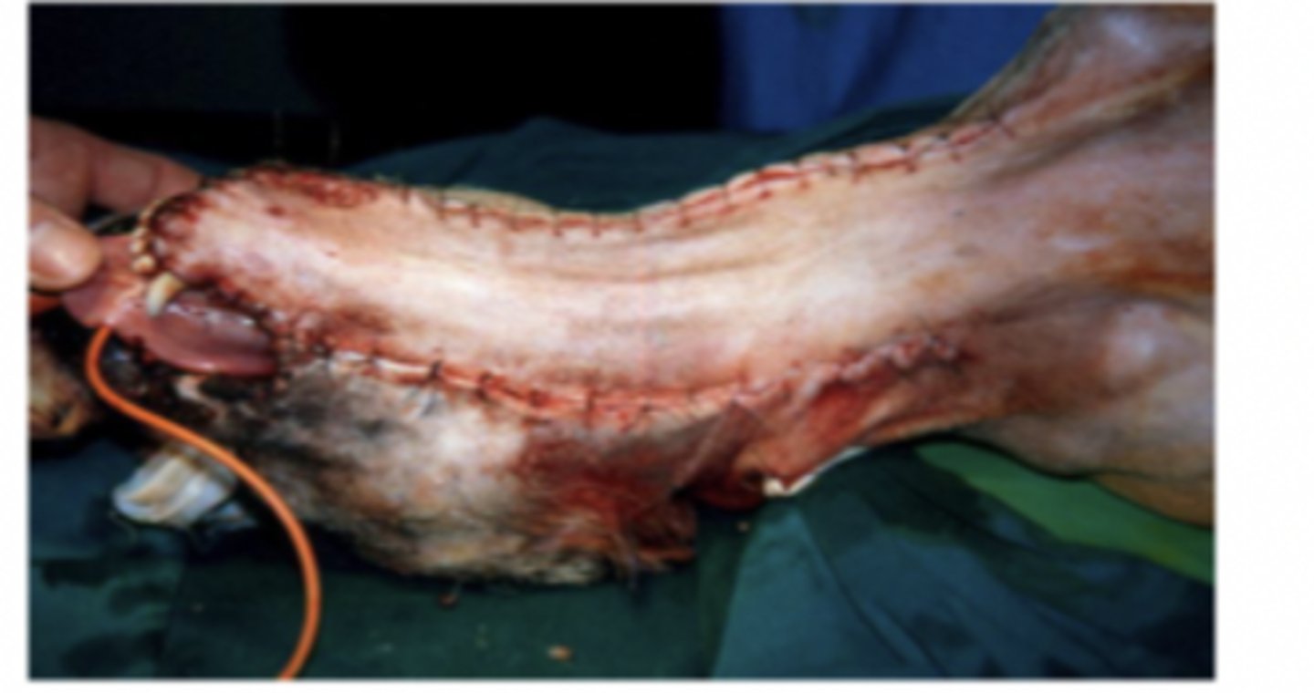 <p>what would your concerns be for this flap?</p>