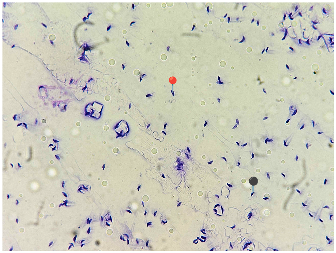 <p><strong><em>Toxoplasma gondii</em></strong></p><p>(Trofozoit)</p><p></p><p></p><p><strong>Parazytoza:</strong><em> Toksoplazmoza</em></p><p></p>