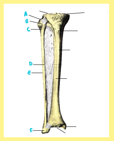 <p><u>Name the following</u>:</p><ul><li><p>Bone?</p></li><li><p>Side?</p></li><li><p>View?</p></li><li><p>F?</p></li></ul><p></p>