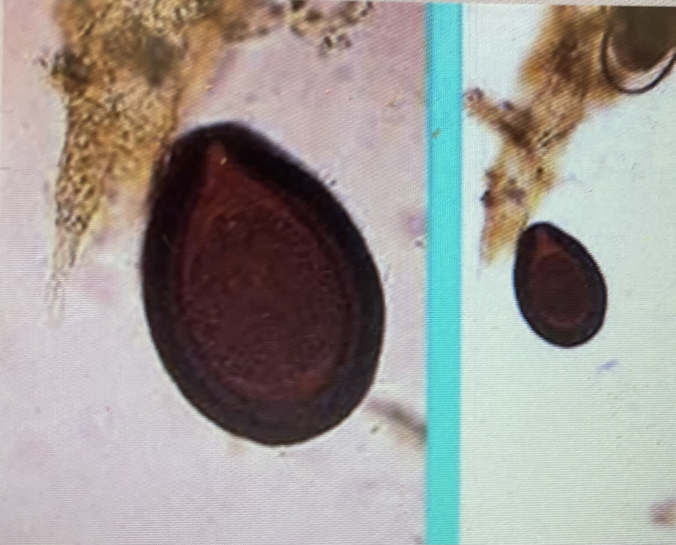 <p>Host species horse </p><p>Size 70-90 um </p><p>Prepatent period 15-33 days Measurement</p><p>Usually found in young animals </p><p></p>