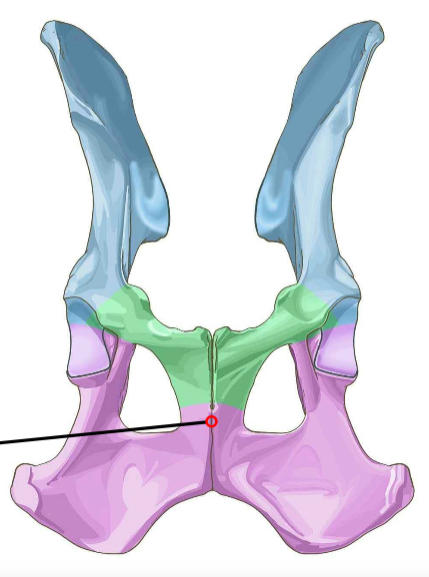 <p>Midline fusion of pubes and ischia; forms pelvic floor.</p>