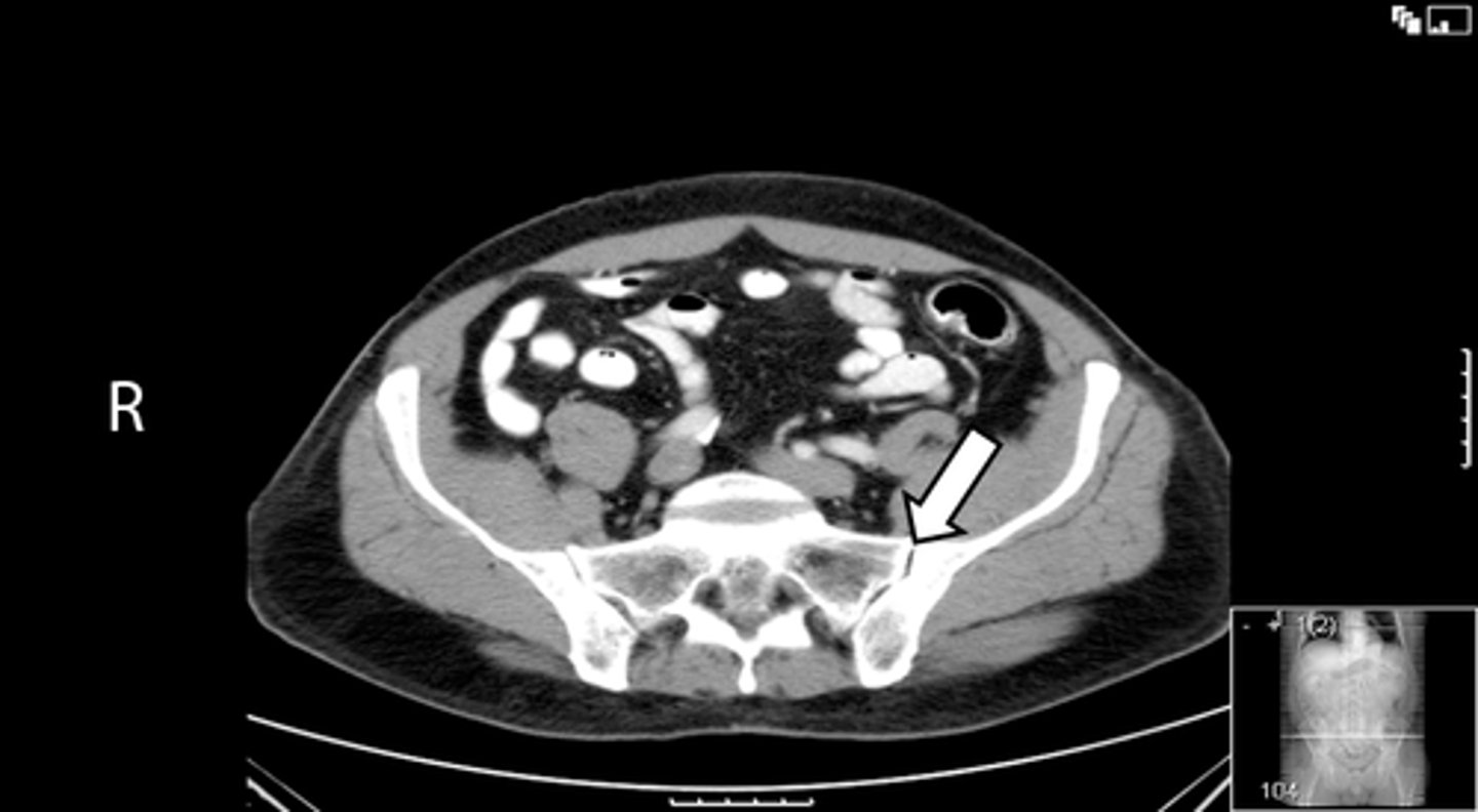 <p>What is indicated in the image?</p>